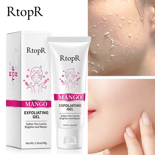 RTopR Mango Acne Exfoliating Cream